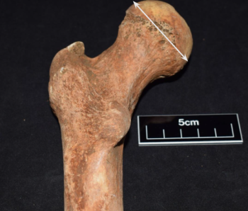 Figure 4: Proximal left femur (posterior view) showing the proximal femoral head (top) measurement, used to ascertain Body mass (Authors own).